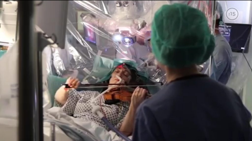 Paciente toca el violín mientras es operada de un tumor cerebral