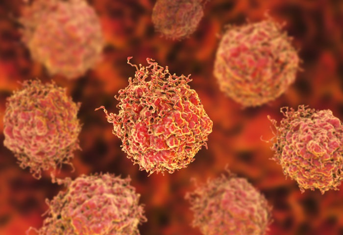 Prueban con éxito fármaco que combate cáncer de próstata avanzado
