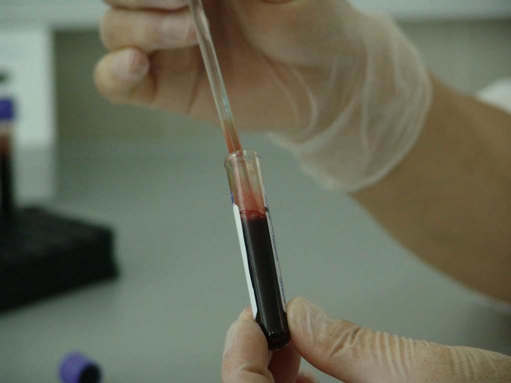 Hospital alemán tratará coronavirus con plasma