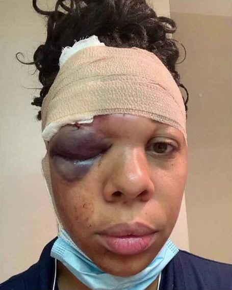 Suspenden a policía de Fort Lauderdale por agredir a manifestante