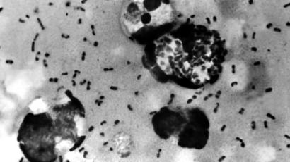 Peste bubónica, la nueva enfermedad que se genera en China