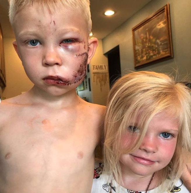 Valentía de un niño asombra y conmueve a Superhéroes de Hollywood