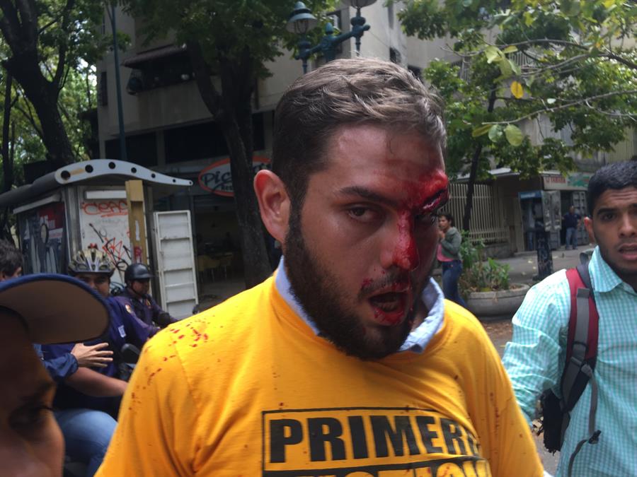 Diputado opositor venezolano Juan Requesens cumple dos años preso