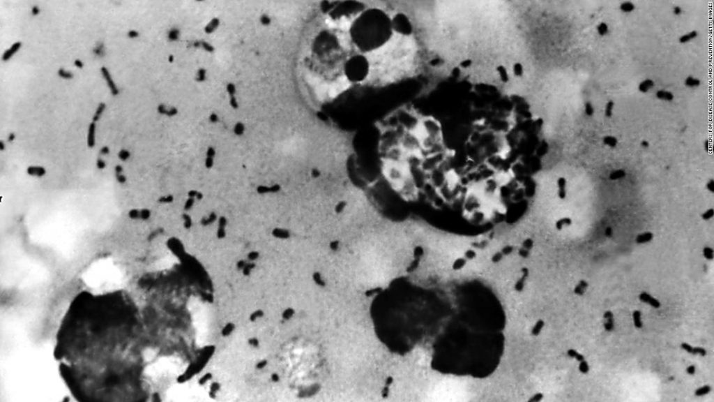 Alerta en China tras muerte por peste bubónica