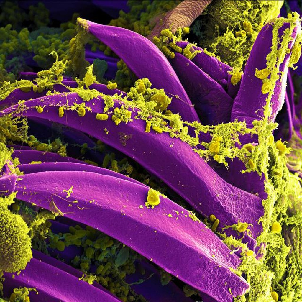 Alerta en California por caso de peste bubónica