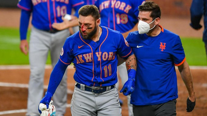 Kevin Pillar sufre múltiples fracturas tras recibir pelotazo en la nariz