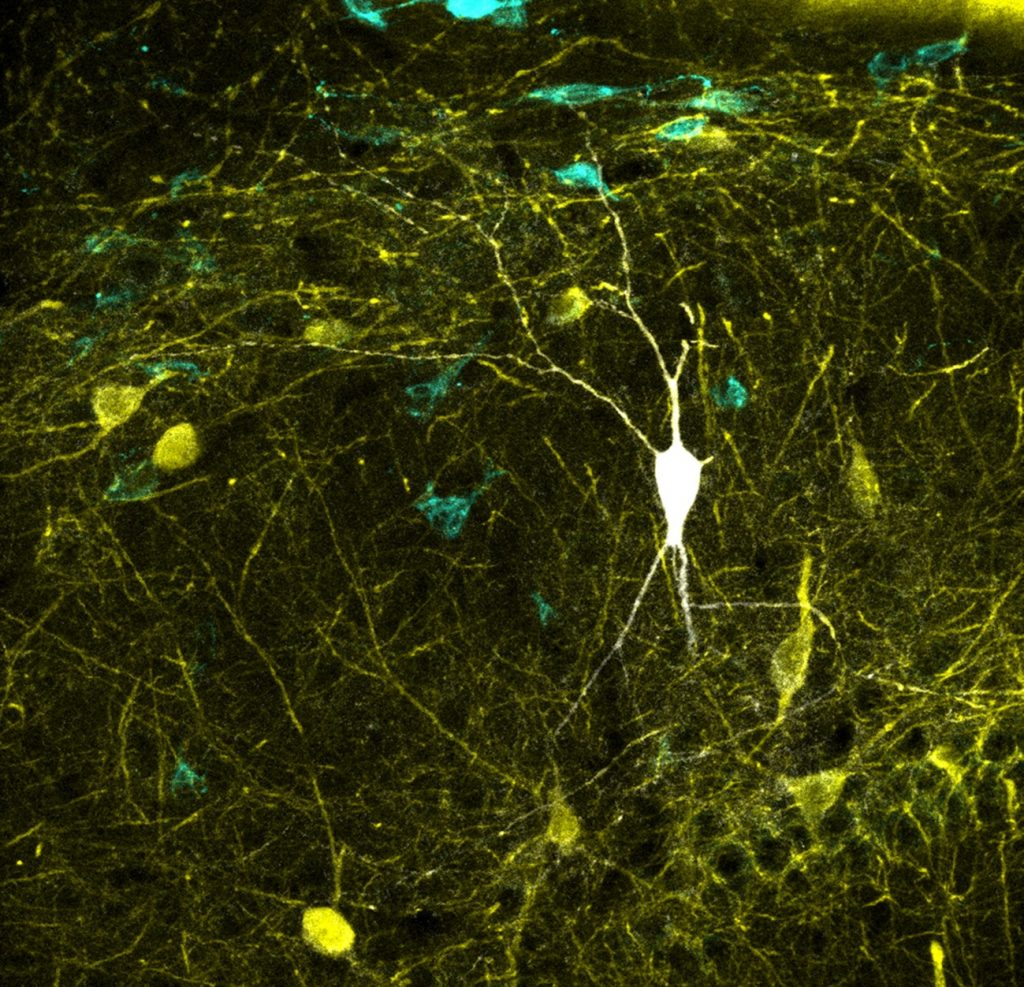 Una base de datos de neuronas mapea la región del cerebro ligada a la memoria
