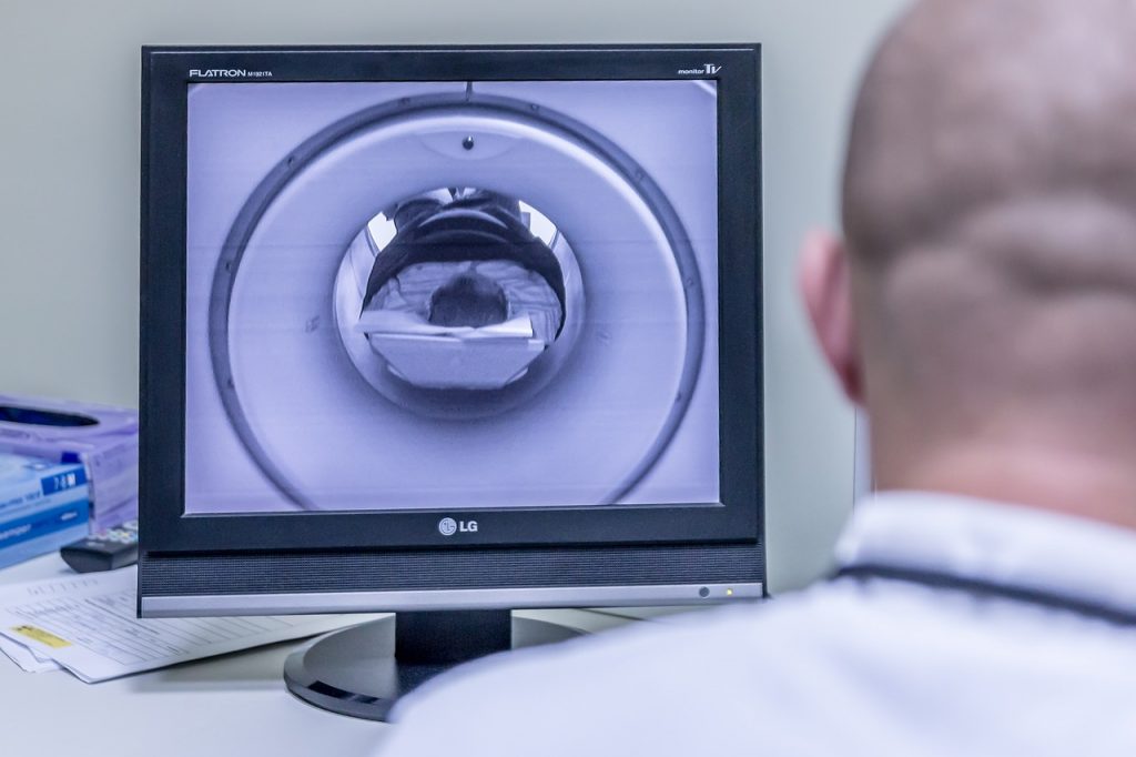 La FDA aprobó el primer fármaco contra el proceso del alzheimer