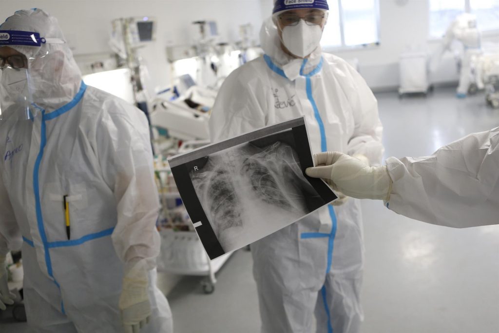 La acumulación del virus en los pulmones es la principal causa de muerte por COVID-19