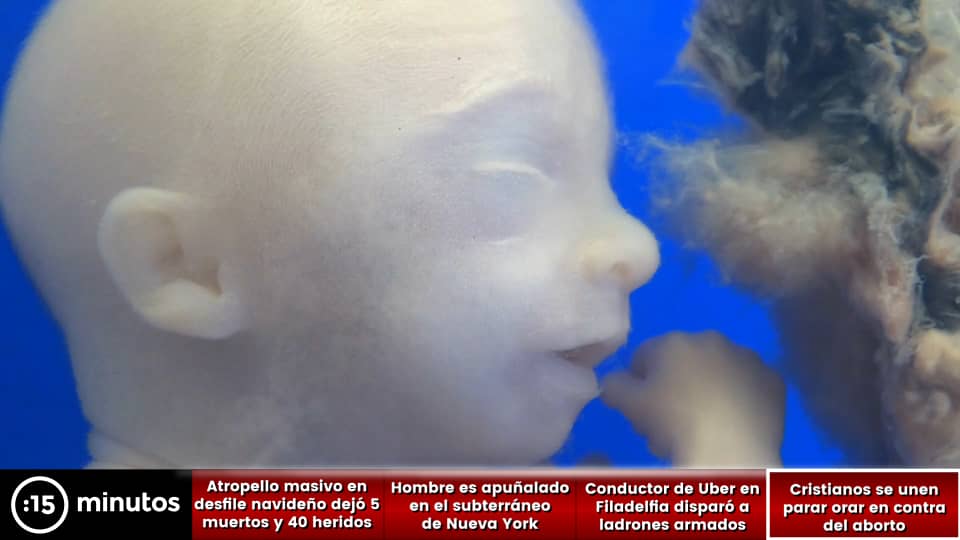 Cristianos se reunirán para orar en contra del aborto