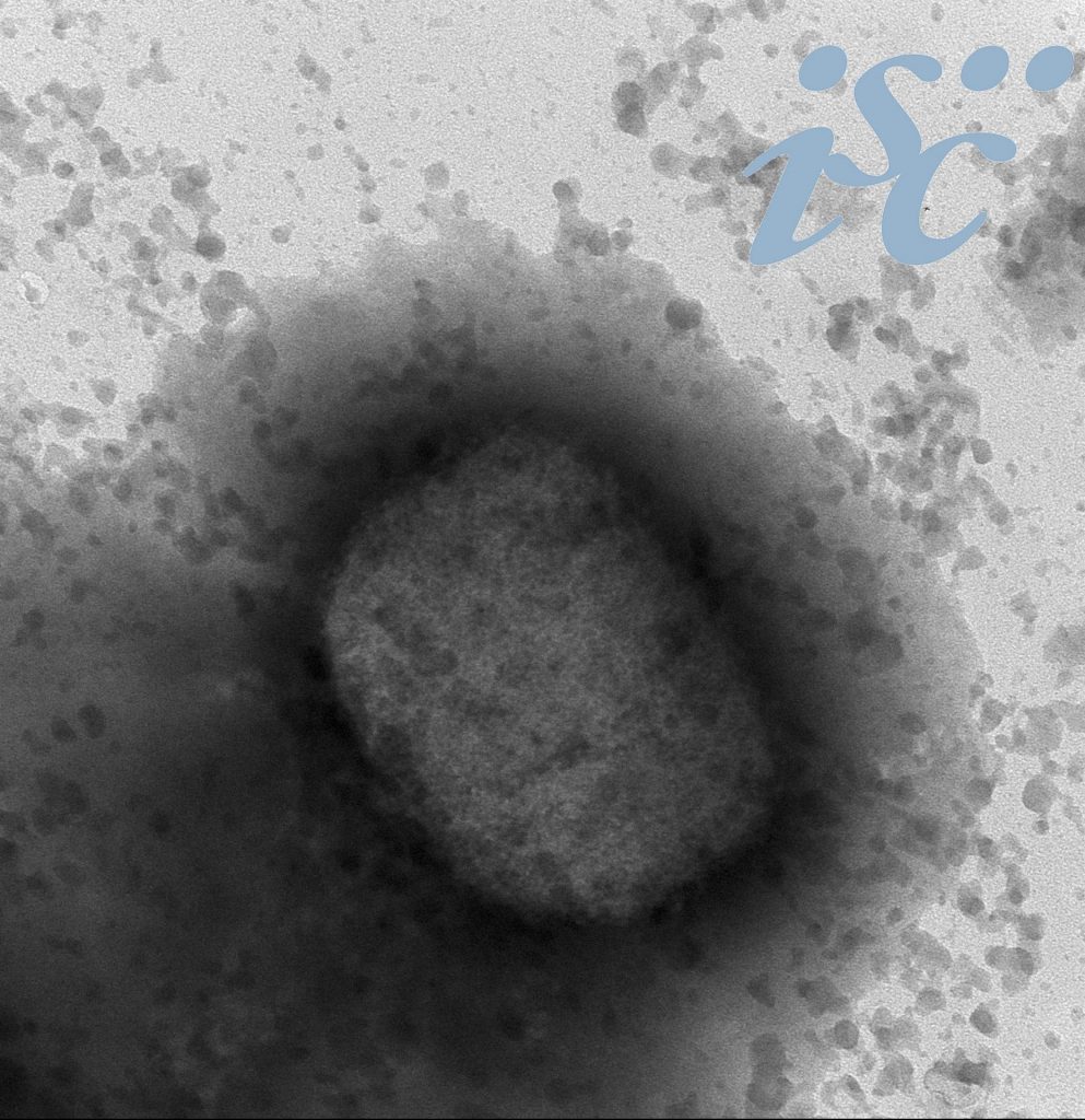 Primera secuencia completa de la viruela del mono en España confirma que el virus es de África Occidental