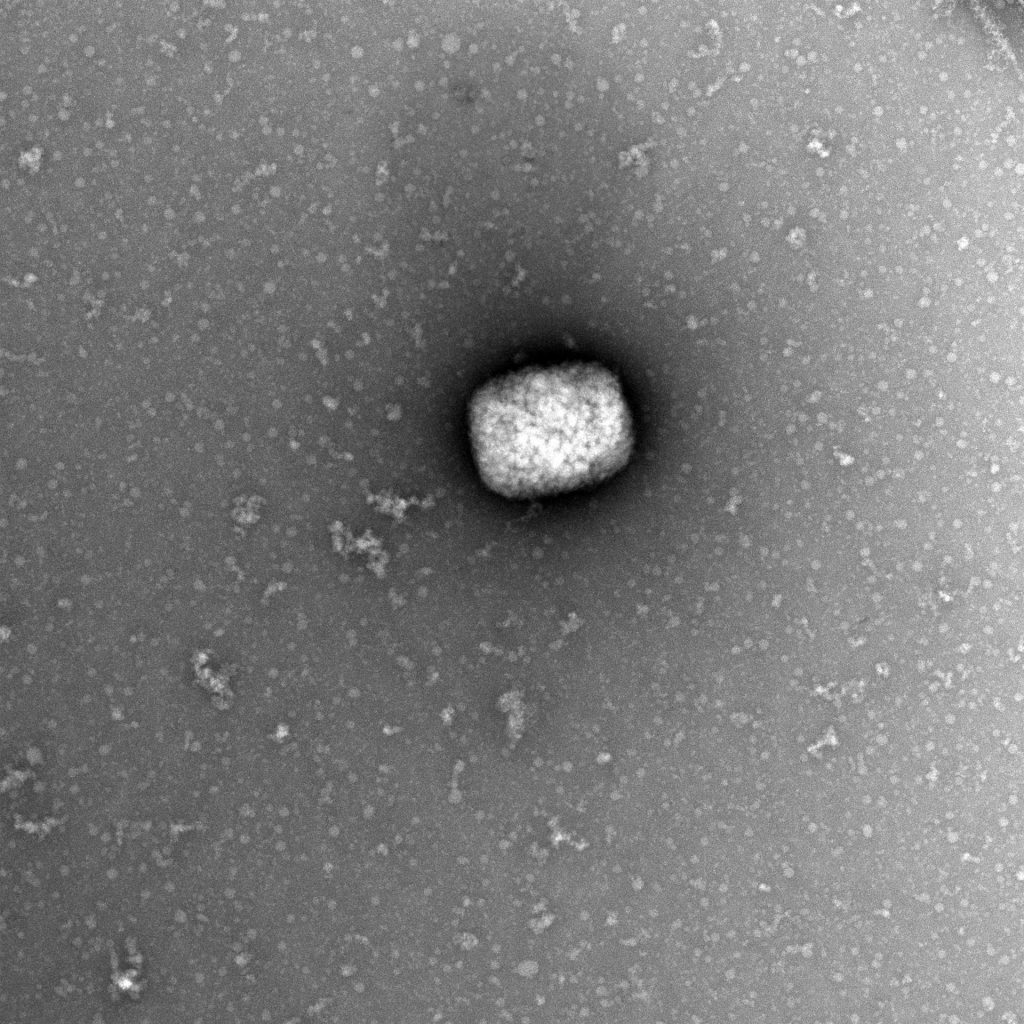 Más de mil casos y transmisión comunitaria OMS alerta que la viruela del mono sigue avanzando