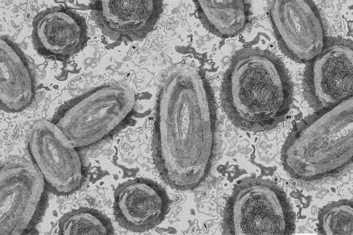 EEUU, optimista ante el menor ritmo de contagios de la viruela del mono