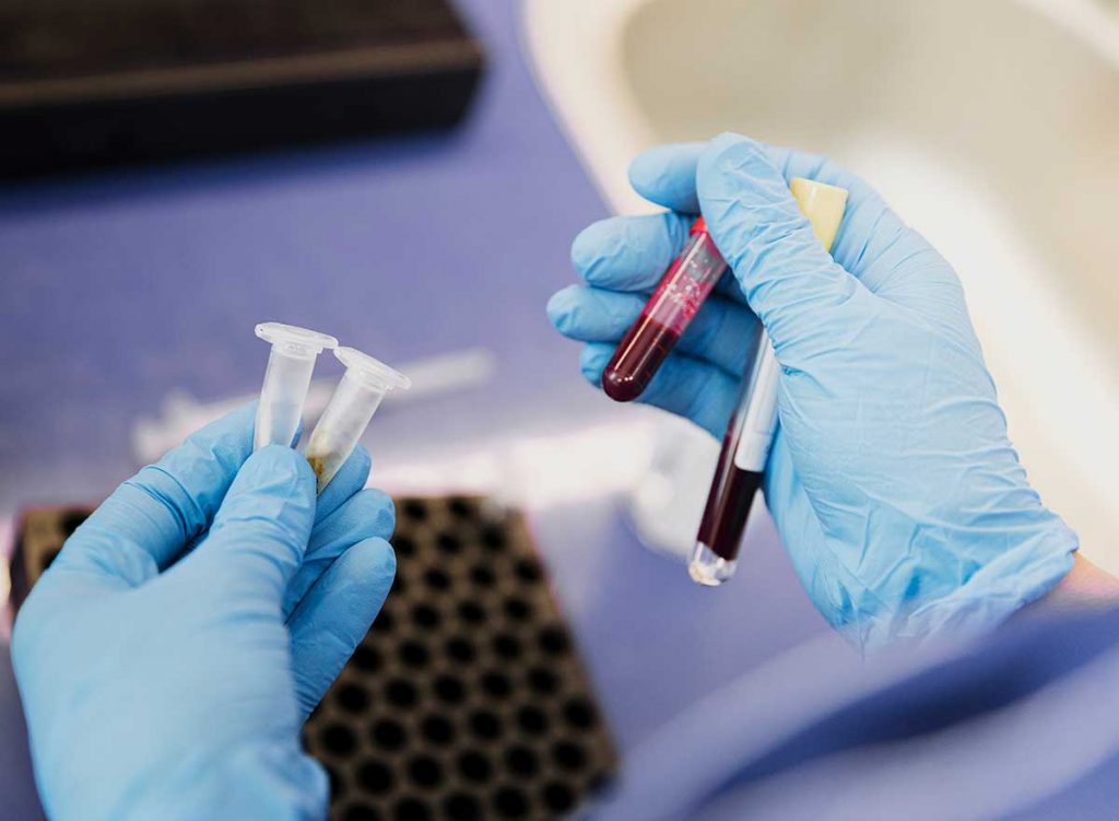 Un análisis de sangre podría detectar cáncer antes de que aparezcan síntomas