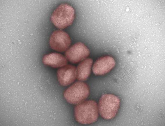 Un estudio muestra la presencia del virus de la viruela del mono en el aire de pacientes infectados