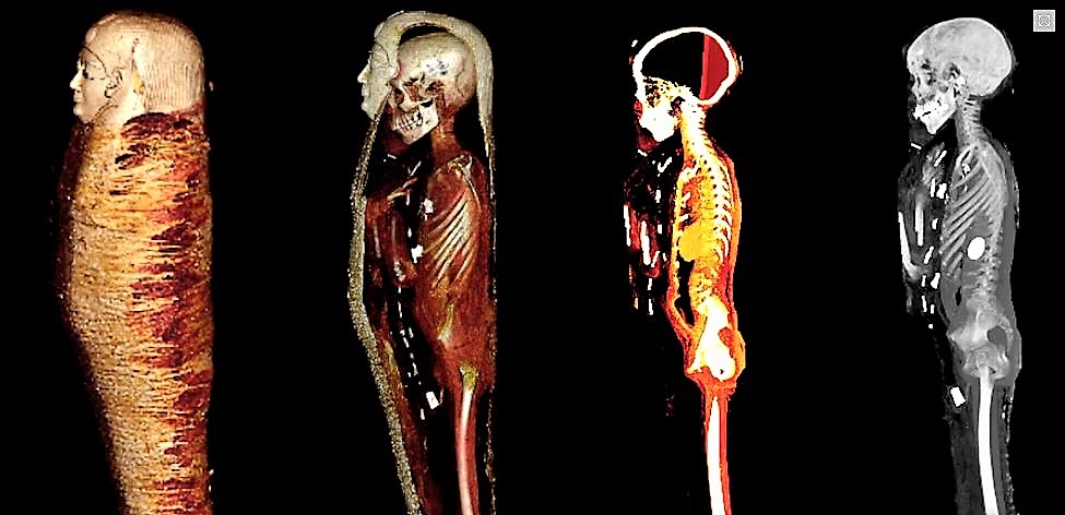 La momia del chico de oro estaba protegida por 49 amuletos preciosos