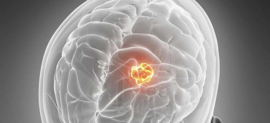 Extirpan tumor de 2 kilos en el hígado de una niña de 10 meses